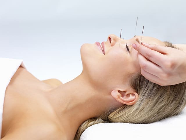 ACUPUNTURA