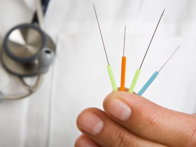 ACUPUNTURA
